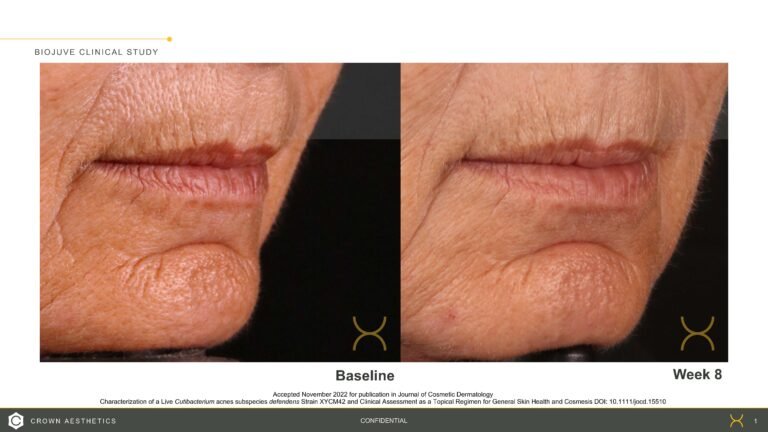 BIOJUVE Before and Afters_20221212 (1)_Page_1