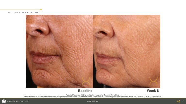 BIOJUVE Before and Afters_20221212 (1)_Page_2