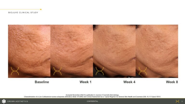 BIOJUVE Before and Afters_20221212 (1)_Page_3