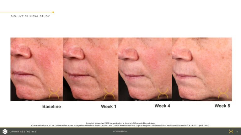 BIOJUVE Before and Afters_20221212 (1)_Page_4