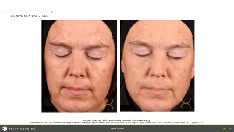 BIOJUVE Before and Afters_20221212 (1)_Page_5