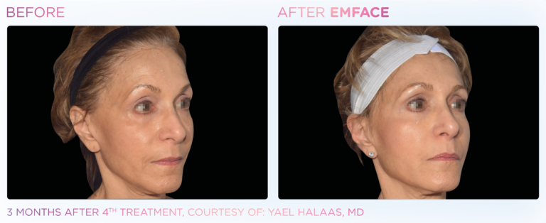 Emface_PIC_Ba-card-female-face-104_ENUS100