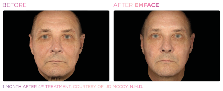 Emface_PIC_Ba-card-male-face-073_ENUS100